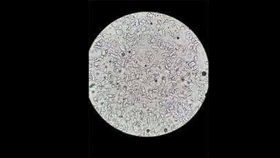 Crystal growth